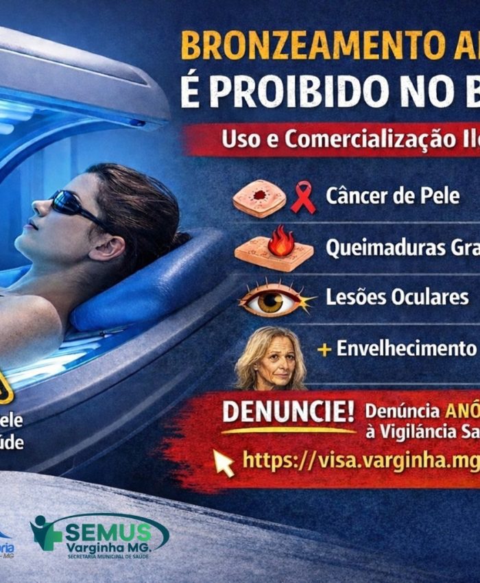 Vigilância Sanitária alerta: uso e comercialização de câmaras de bronzeamento artificial são proibidos e oferecem graves riscos à saúde